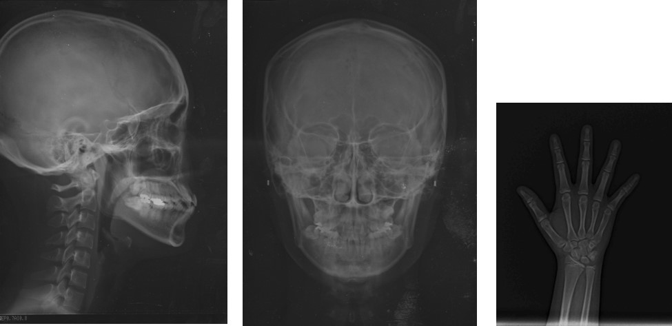 矯正の検査って何をするの 何がわかるの 矯正治療前の精密検査について なんぽ歯科クリニック新百合ヶ丘 新百合ヶ丘の矯正専門歯科医院